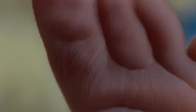 signs of cat limping